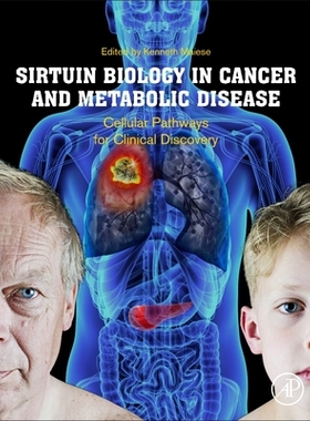 【预订】Sirtuin Biology in Cancer and Metabolic Disease: Cellular Pathways for Clinical Discovery