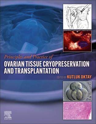[预订]Principles and Practice of Ovarian Tissue Cryopreservation and Transplantation 9780323957533