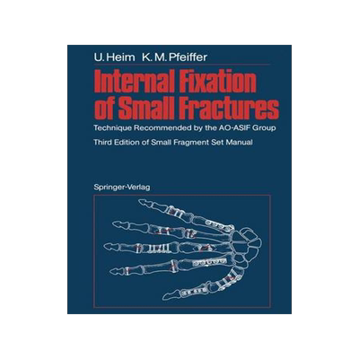 预订 Internal Fixation of Small Fractures