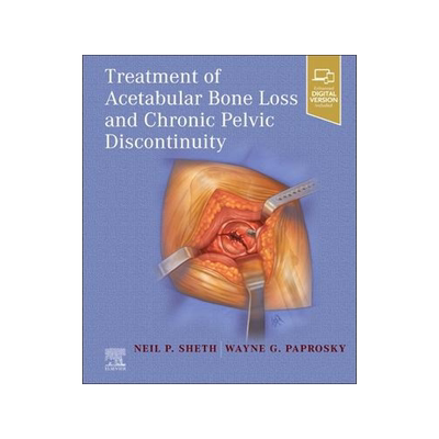 [预订]Treatment of Acetabular Bone Loss and Chronic Pelvic Discontinuity 9780323875509