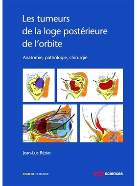 预订 Les tumeurs de la loge postérieure de l’orbite : anatomie, pathologie, chirurgie. Vol. 3. Chirurgie 眼眶后室肿瘤