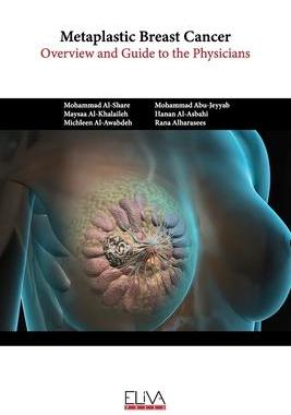 [预订]Metaplastic Breast Cancer: Overview and guide to the physicians 9789994983612