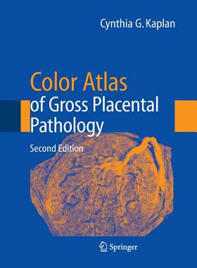 【预订】Color Atlas of Gross Placental Pathology