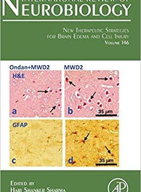 【预售】New Therapeutic strategies for Brain Edema and Cell Injury