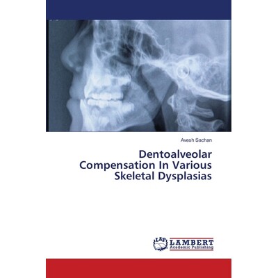 预订 Dentoalveolar Compensation in Various Skeletal Dysplasias: 9783659381775