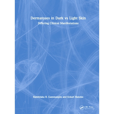 Differing Clinical Manifestations
