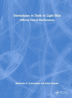 预订 Dermatoses in Dark Vs Light Skin: Differing Clinical Manifestations 深色皮肤与浅色皮肤的皮肤病：不同的临床表现: 978