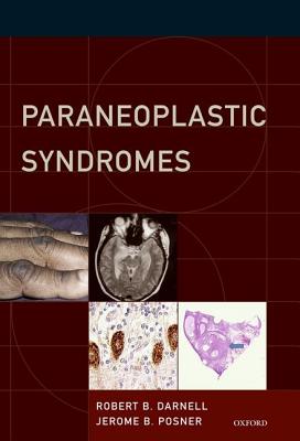 【预订】Paraneoplastic Syndromes