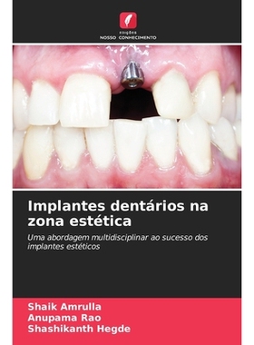 预订 Implantes dentários na zona estética: Uma abordagem multidisciplinar ao sucesso dos implantes estéticos. DE: 978