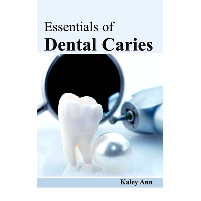 预订 Essentials of Dental Caries 龋齿要点: 9781632421869