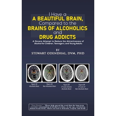 预订 I Have a Beautiful Brain, Compared to the Brains of Alcoholics and Drug Addicts: 9798889109891