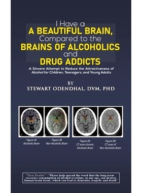预订 I Have a Beautiful Brain, Compared to the Brains of Alcoholics and Drug Addicts: 9798889109891