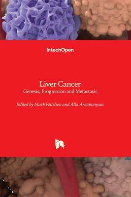 [预订]Liver Cancer - Genesis, Progression and Metastasis 9781803564135