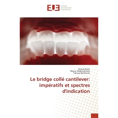 预订 Le bridge collé cantilever: impératifs et spectres d’indication: 9786202426763