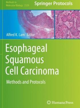 【预订】Esophageal Squamous Cell Carcinoma
