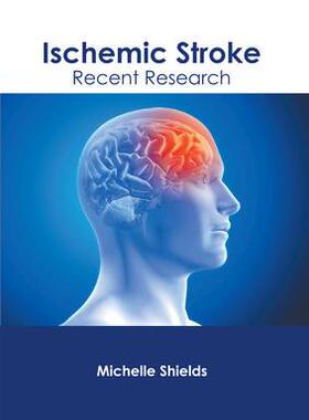 [预订]Ischemic Stroke: Recent Research 9781632429179