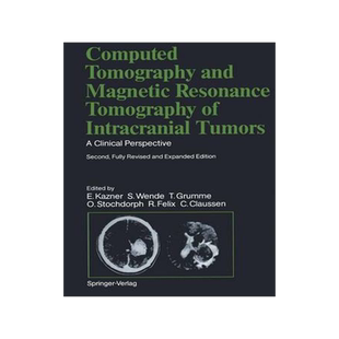 预订 Computed Tomography and Magnetic Resonance Tomography of Intracranial Tumors
