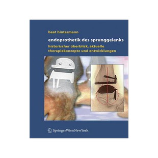 预订 Endoprothetik des Sprunggelenks