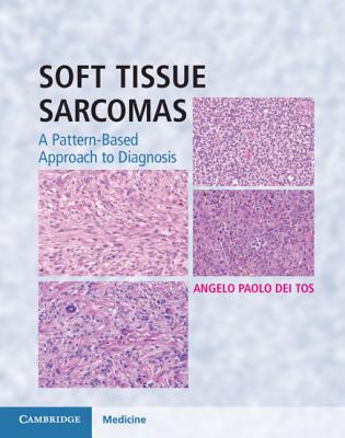 【预订】Soft Tissue Sarcomas Hardback with Online Resource
