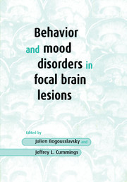 【预订】Behavior and Mood Disorders in Focal Brain Lesions