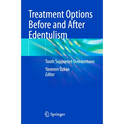 Tooth Supported Overdentures