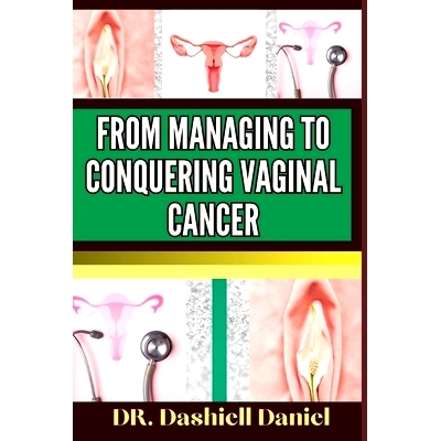 预订 From Managing to Conquering Vaginal Cancer: Expert Guide To Understanding The Causes, Recognizing Symptoms, And Nav