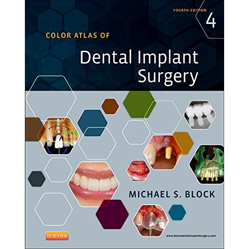 预订 Color Atlas of Dental Implant Surgery 牙科种植学图解 第4版 9781455759682
