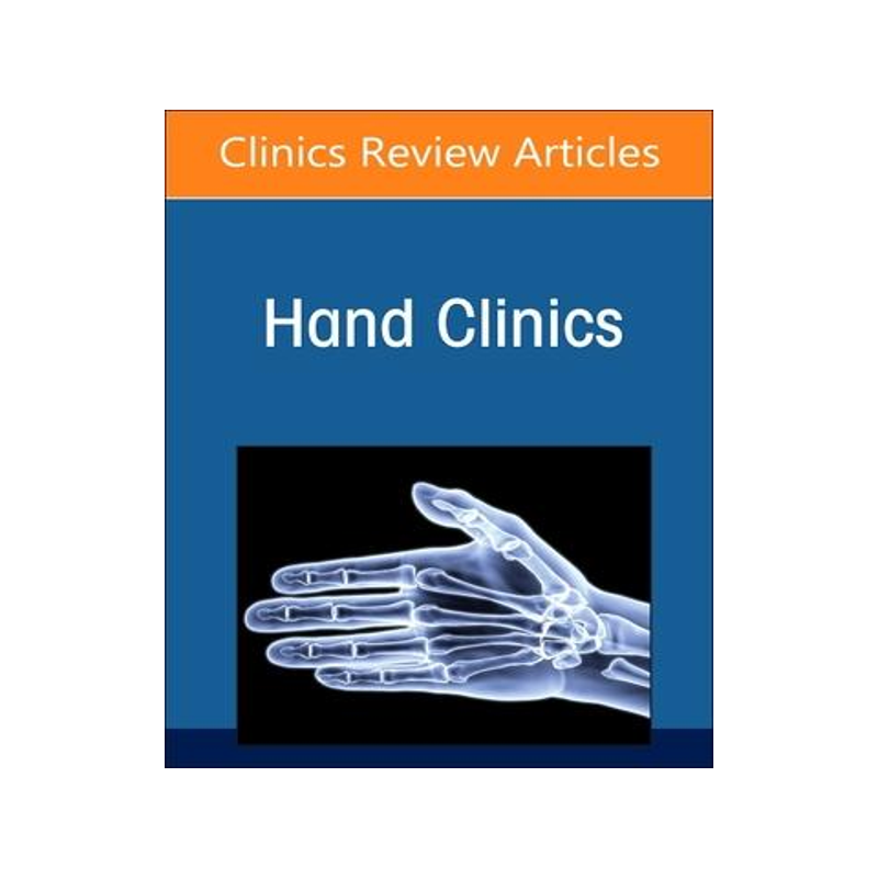 [预订]Managing Difficult Problems in Hand Surgery 9780323940054