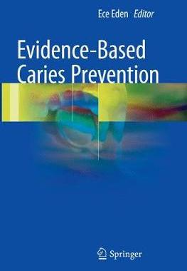 预订 Evidence-Based Caries Prevention