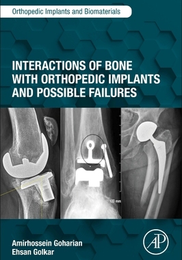 【预订】Interactions of Bone with Orthopedic Implants and Possible Failures 9780323954105