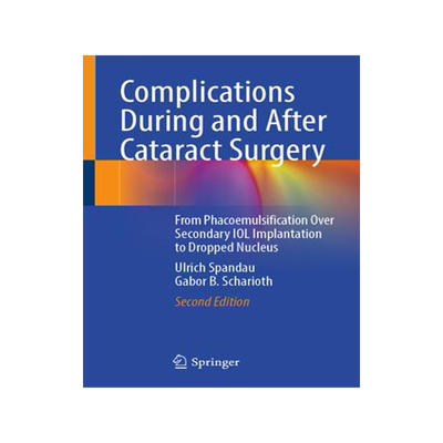 [预订]Complications During and After Cataract Surgery 9783030935306