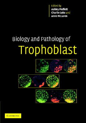 【预订】Biology and Pathology of Trophoblast