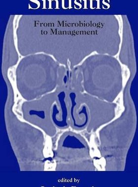 【预订】Sinusitis