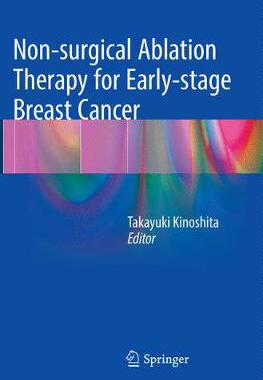 预订 Non-surgical Ablation Therapy for Early-stage Breast Cancer