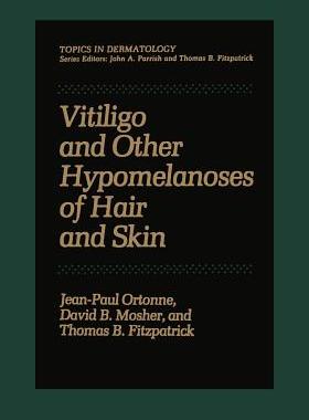 【预订】Vitiligo and Other Hypomelanoses of Hair and Skin