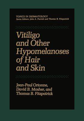 【预订】Vitiligo and Other Hypomelanoses of Hair and Skin