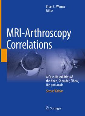 [预订]MRI-Arthroscopy Correlations 9783030947880