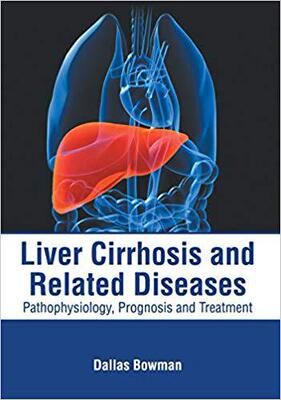 【预售】Liver Cirrhosis and Related Diseases: Pathophysiology, Prognosis and Treatment