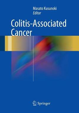 【预订】Colitis-Associated Cancer
