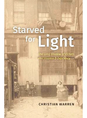 预订 Starved for Light: The Long Shadow of Rickets and Vitamin D Deficiency 缺乏光明：软骨病和维生素D缺乏症的长期阴影: 9