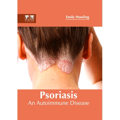 预订 Psoriasis: An Autoimmune Disease 牛皮癣：一种自身免疫性疾病: 9781632424754