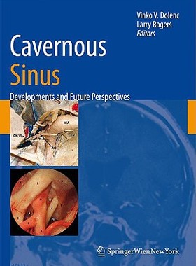 【预订】Cavernous Sinus