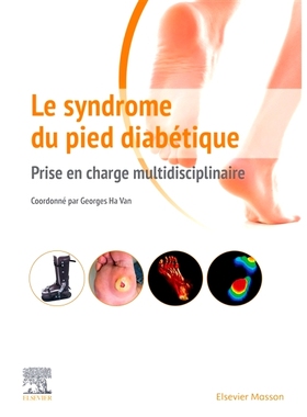 预订 Le syndrome du pied diabétique : prise en charge multidisciplinaire 糖尿病足综合征：多学科护理: 9782294762437