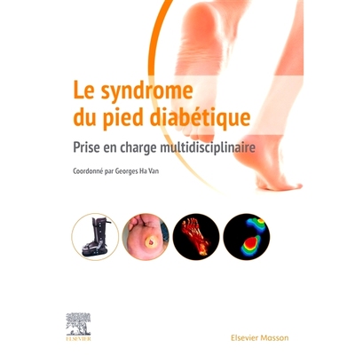 预订 Le syndrome du pied diabétique : prise en charge multidisciplinaire 糖尿病足综合征：多学科护理: 9782294762437