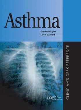 【预订】Asthma