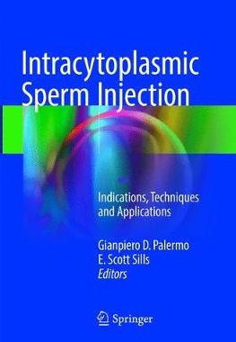 预订 Intracytoplasmic Sperm Injection
