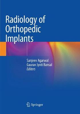 【预订】Radiology of Orthopedic Implants