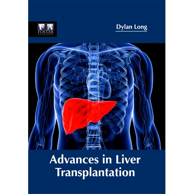 预订 Advances in Liver Transplantation 肝移植的进展: 9781632424730