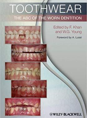【预售】Toothwear - the Abc of the Worn Dent...