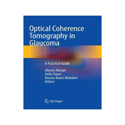 预订 Optical Coherence Tomography in Glaucoma